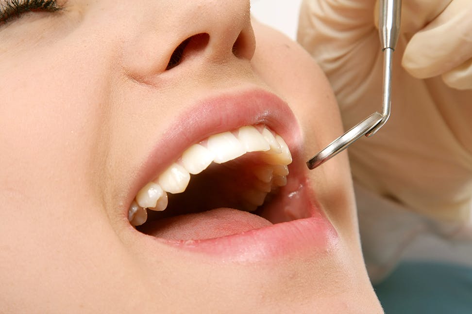 Dental Cleanings and Oral Examinations